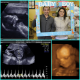 View a Miracle 4D Ultrasounds