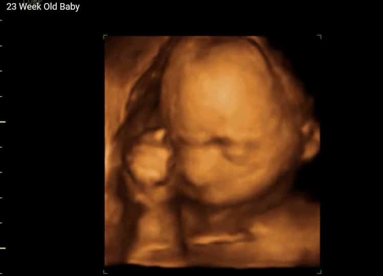 4d ultrasound pictures at 23 weeks