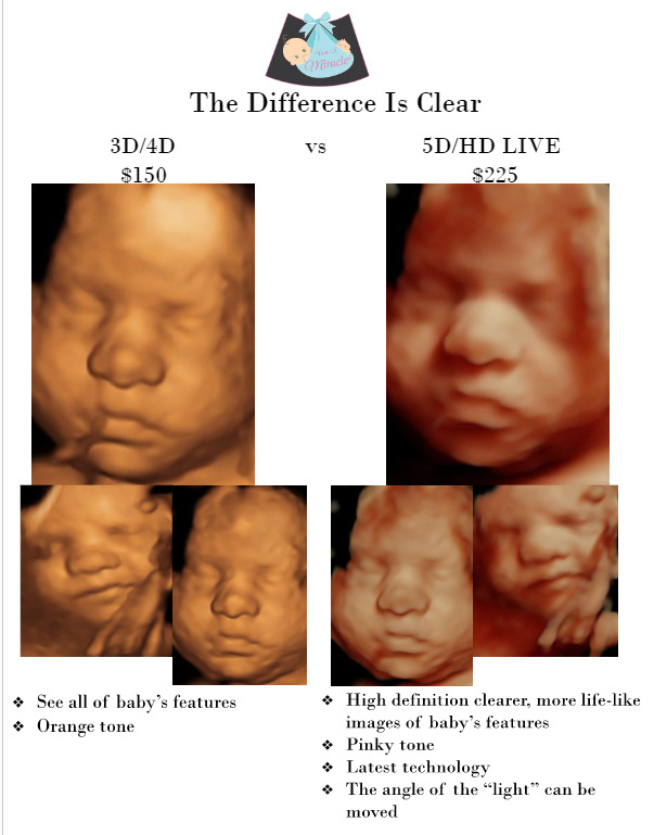 View A Miracle is proud to announce that we have 5D/ HD LIVE ultrasounds!