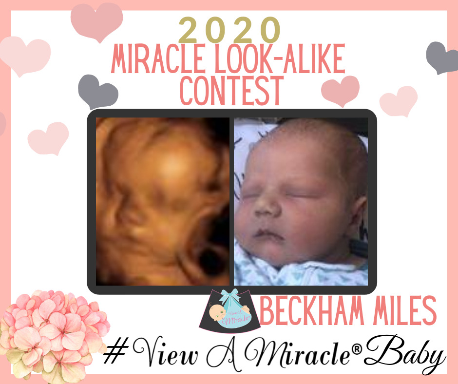 2020 MIRACLE LOOK-ALIKE CONTEST