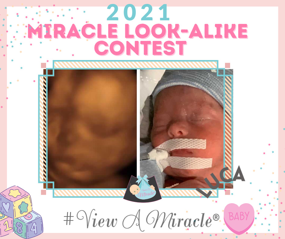Miracle Look-Alike Contest