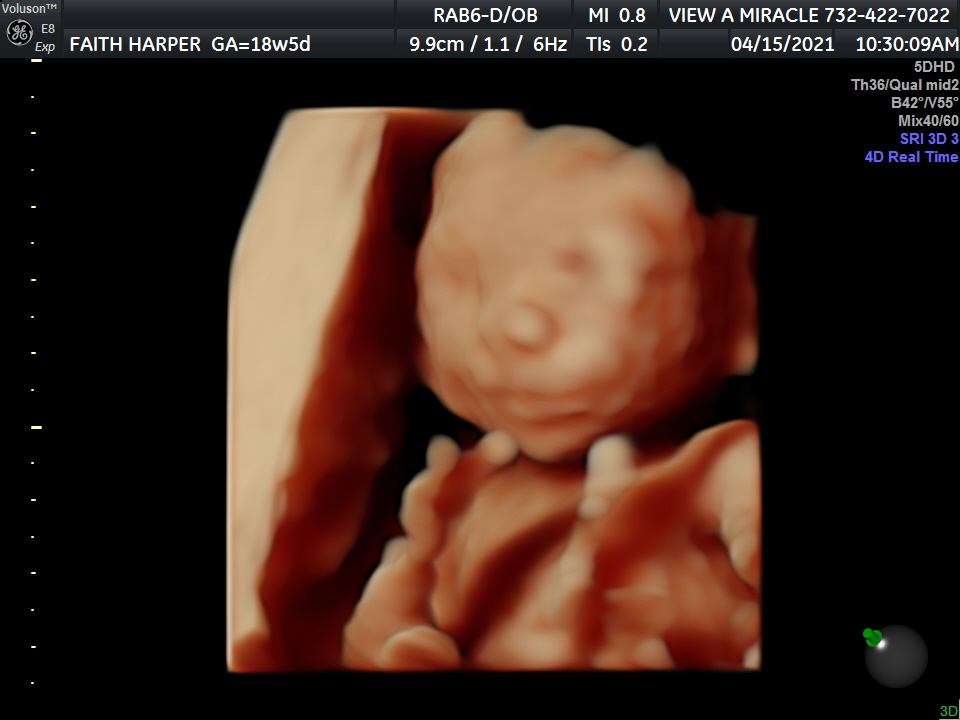23 weeks 4d ultrasound