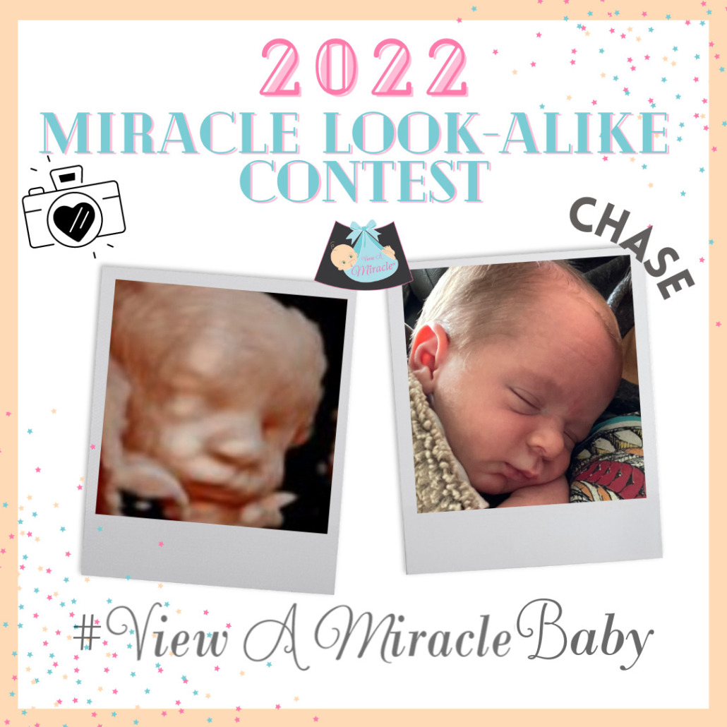 Our Previous #ViewAMiracleBaby MIRACLE LOOK-ALIKE CONTEST ENTRIES