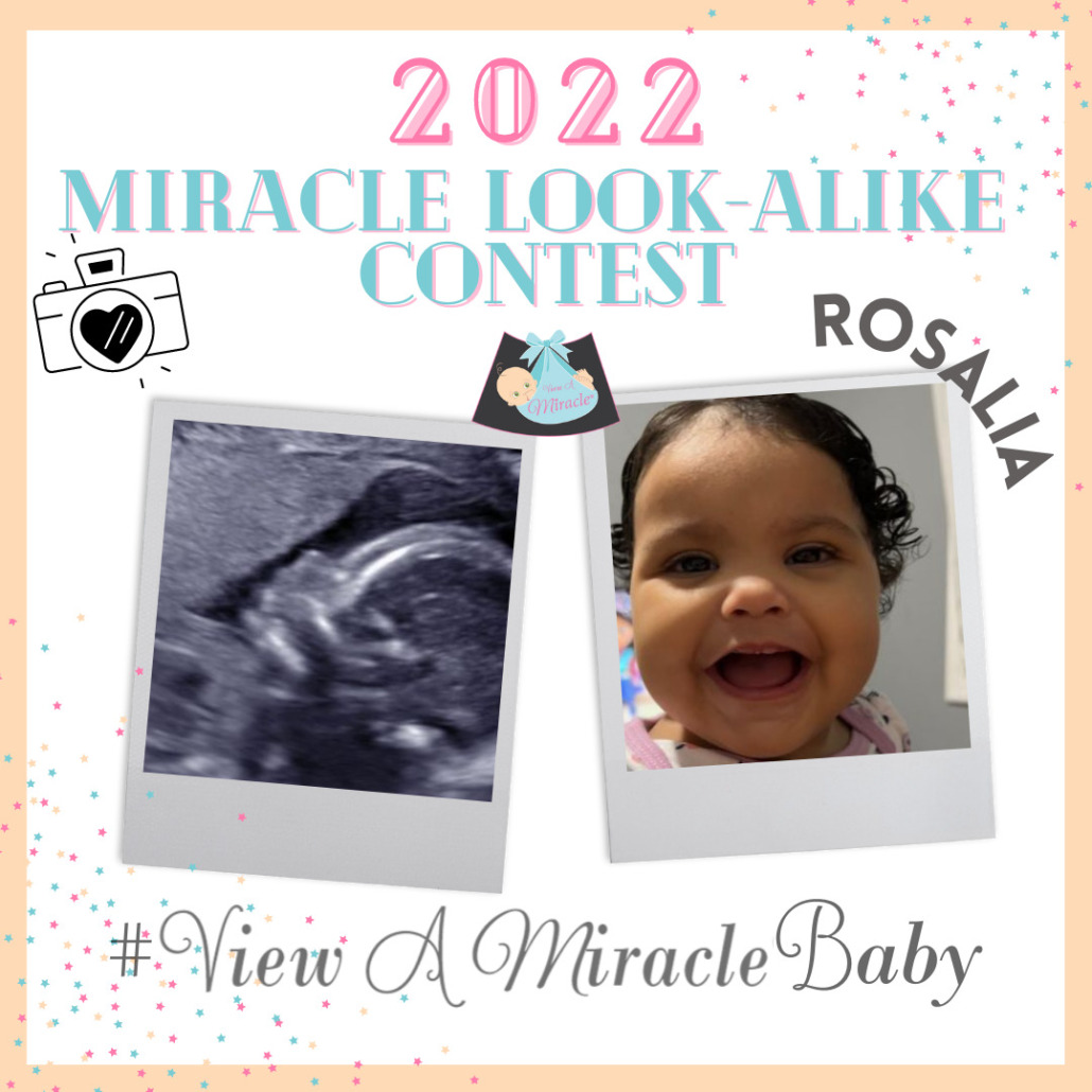 Our Previous #ViewAMiracleBaby MIRACLE LOOK-ALIKE CONTEST ENTRIES