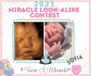 Miracle Look-Alike Contest